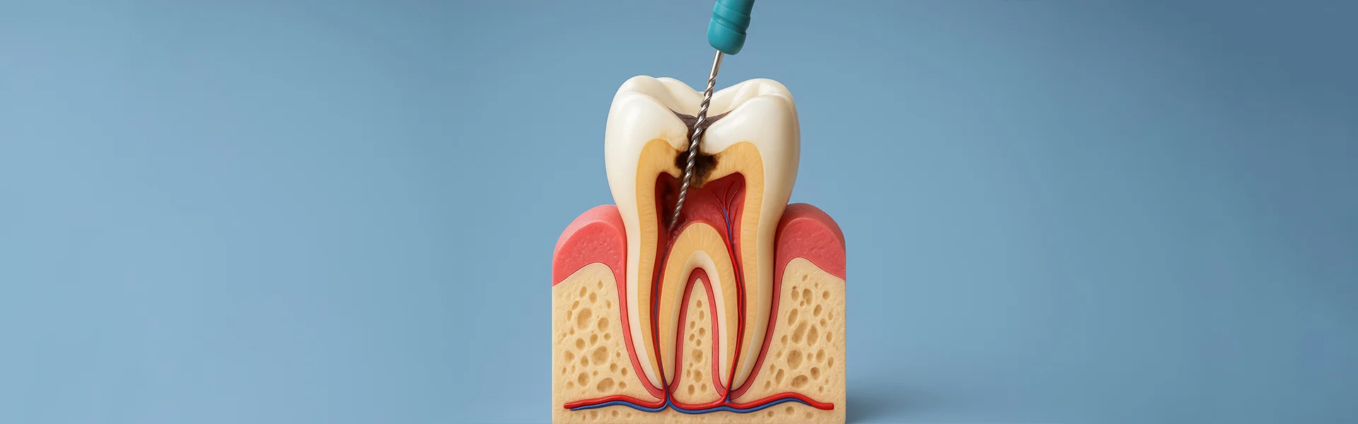 What Happens In Case You Delay a Root Canal?